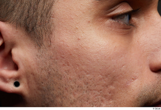 HD Face Skin Shawn Jacobs cheek eye face hair skin…